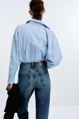 Pantalón de jean azul de tiro alto, corte mom fit, tobillero y con cinco bolsillos. Cierre frontal con cremallera y botón.